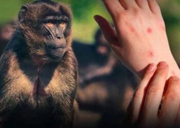 থাইল্যান্ডে এমপক্সের নয়া ধরনের সন্ধান পাওয়া গেছে