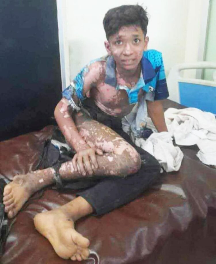 কর্ণফুলীতে স্বাস্থ্য কমপ্লেক্সের মাঠে গোপন হাটে বিদ্যুৎস্পৃষ্টে দগ্ধ কিশোর