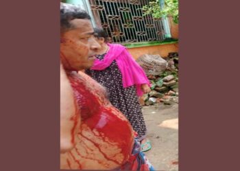 পটিয়ায় প্রতিপক্ষের হামলায় পল্লী বিদ্যুৎ কর্মকর্তা আহত