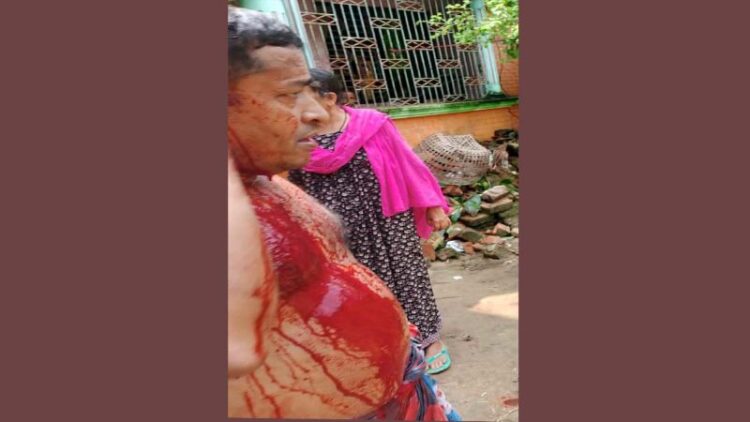 পটিয়ায় প্রতিপক্ষের হামলায় পল্লী বিদ্যুৎ কর্মকর্তা আহত