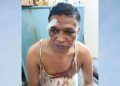 সীতাকুণ্ডে সাংবাদিক লিটন কুমার চৌধুরীর ওপর সন্ত্রাসী হামলা