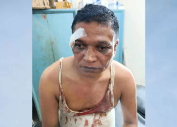 সীতাকুণ্ডে সাংবাদিক লিটন কুমার চৌধুরীর ওপর সন্ত্রাসী হামলা